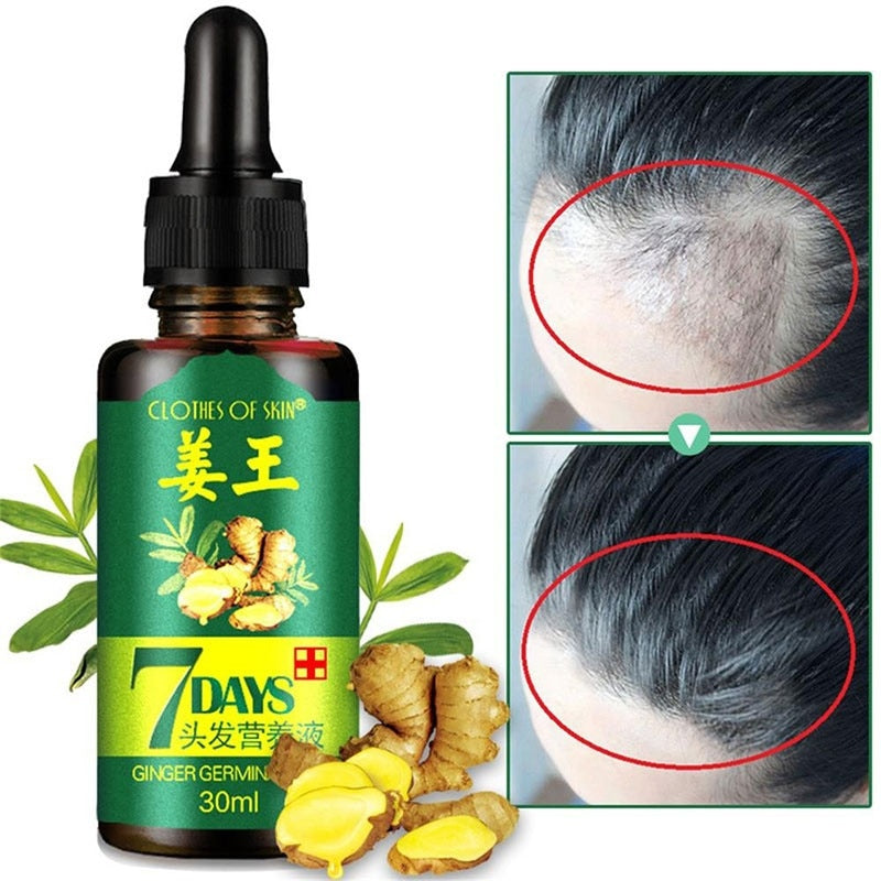 7 Days 30ML Effective Hair Growth Ointment Oil
